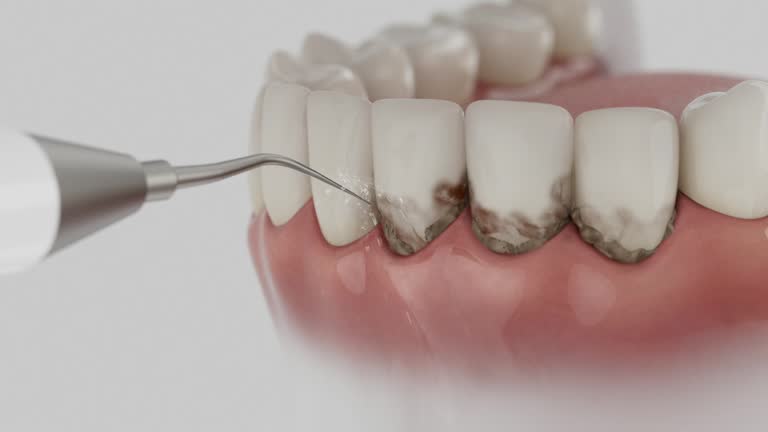 Trusted Wisdom Tooth Removal service in Rodney Village, DE - Dentist Open Now